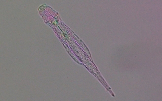 Bdelloid rotifer