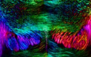 Mouse coronal brainstem, birefringence image. Credit: Michael Shribak and Timothy Balmer