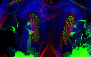 Squid statocyst (inner ear sense organ in some aquatic invertebrates).  Image taken with Zeiss LSM710 in BIE course 2017. Courtesy of Mirko Scheibinger