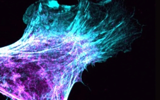 A migrating fibroblast shows myosin in purple and actin in blue. Image courtesy Patrick Oakes