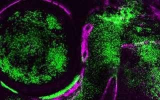 A live adult zebrafish showing showing Pou3f3 gene activity (green) in the gill cover, jaw support skeleton, and eye. Bone-forming cells are labeled in magenta. (Image by Peter Fabian/USC Stem Cell)