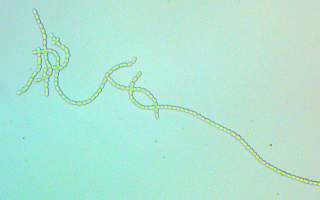 Filamentous cyanobacteria N punctiforme