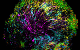 A colorful microscopy image showing a branching tree structure of bacteria.