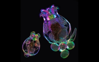 Two microscopic rotifers 