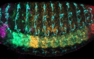 A microscopy image on a black background 