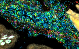Bacteria in a model human gut microbiome established in a germ-free mouse. Each bacterial species is lit up with a different colored probe, creating a map of the community's spatial organization. 