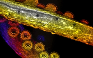 Imaging photo of Arm muscles of Octopus bimaculoides 