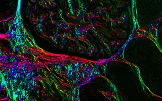 Glomerular capillaries in kidney tissue imaged with the polychromatic polarization microscope developed at MBL