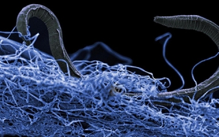 A nematode (eukaryote) in a biofilm of microorganisms. 
