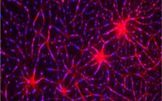 Assembly of a T-cell receptor pathway in vitro using 12 purified components on model membranes. An actin network (red) was induced by LAT clustering (blue). 