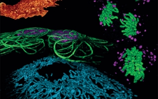 Cellular structures as seen by Bessel beam plane illumination microscopy. 
