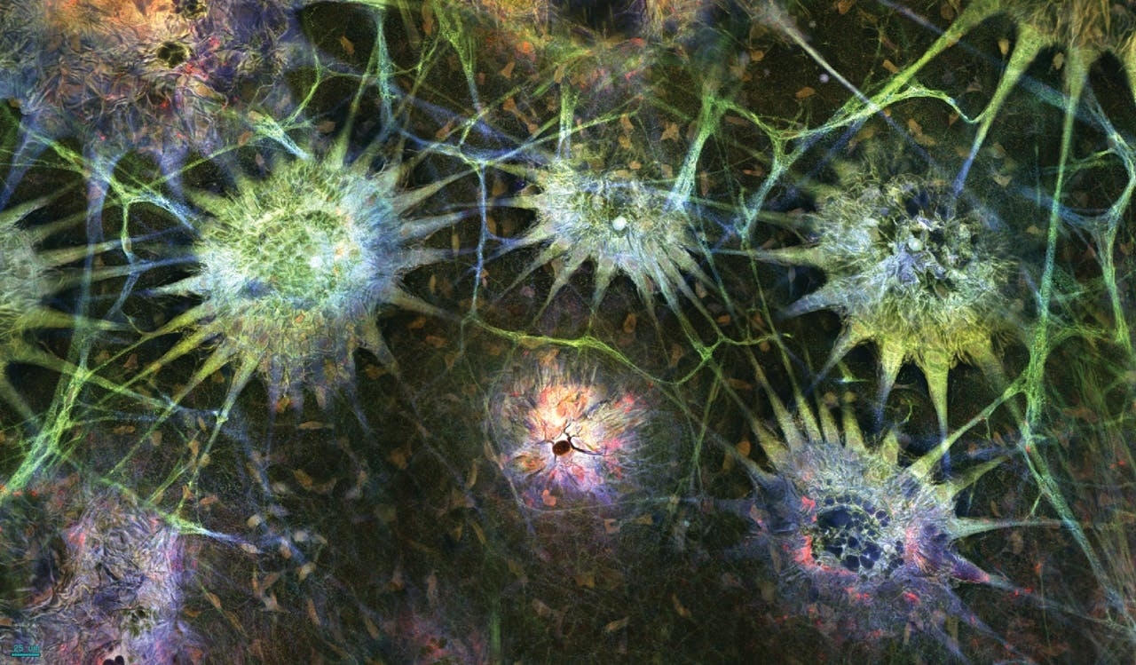 These starburst bunches are chromatophores on the adult squid’s skin, stained with antibodies. The radial projections are muscles, and the other connecting lines are likely nerves. The whole picture is only about a millimeter and a half across. Credit: Steve Senft