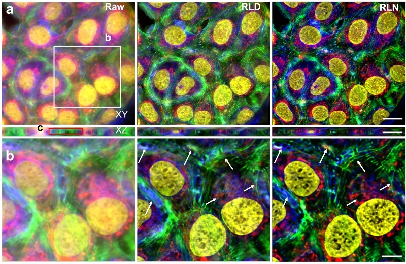 Raw images of human cancer cells processed with Richardson-Lucy Deconvolution (RLD, top) and a neural network that uses RLD (RLN, bottom). Arrows in the close-up view show better detail in images processed with RLN. Credit: Li et al., Nature Methods 2022