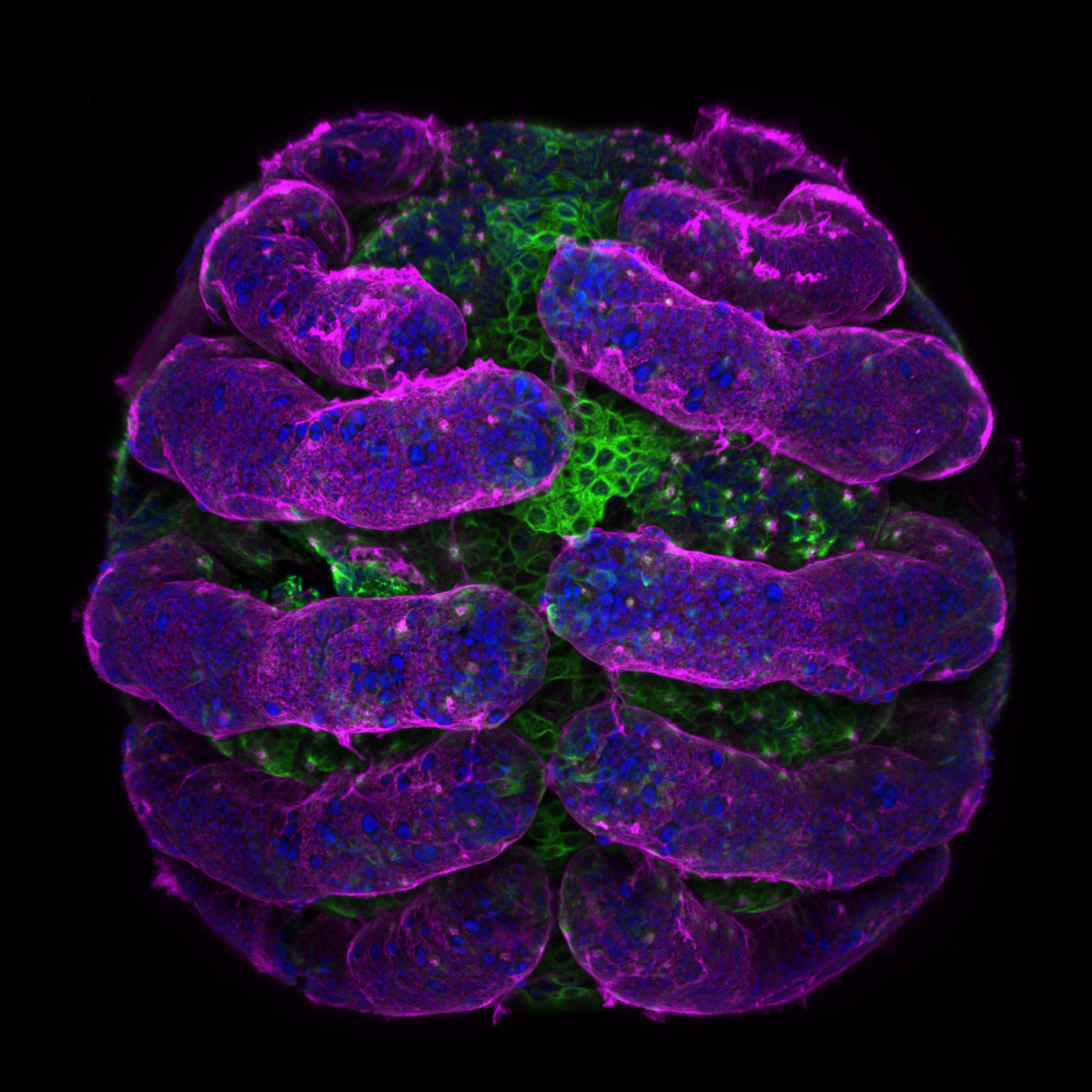 Parasteatoda tepidariorum (spider embryo)stained for embryo surface (pink), nuclei (blue) and microtubules (green). Credit: Tessa Montague