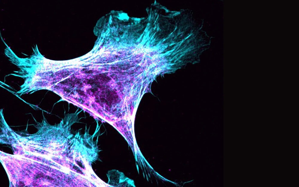 A migrating fibroblast shows myosin in purple and actin in blue. Image courtesy Patrick Oakes