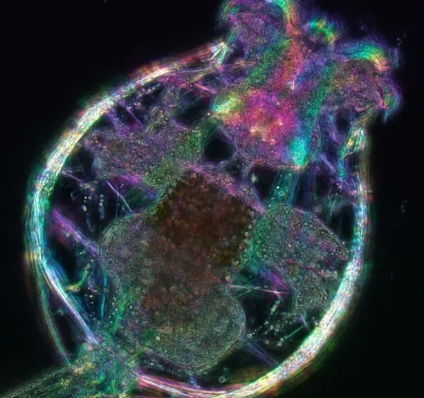 This young female rotifer is about 0.5 millimeters long, and has cilia (at the top) used for swimming and feeding, a large jaw for grinding food, a gut packed with brown algae, reproductive organs, bands of muscles running around the body, and a long, tail-like “foot” ending in two tiny toes. Michael Shribak and Kristin Gribble/Marine Biological Laboratory