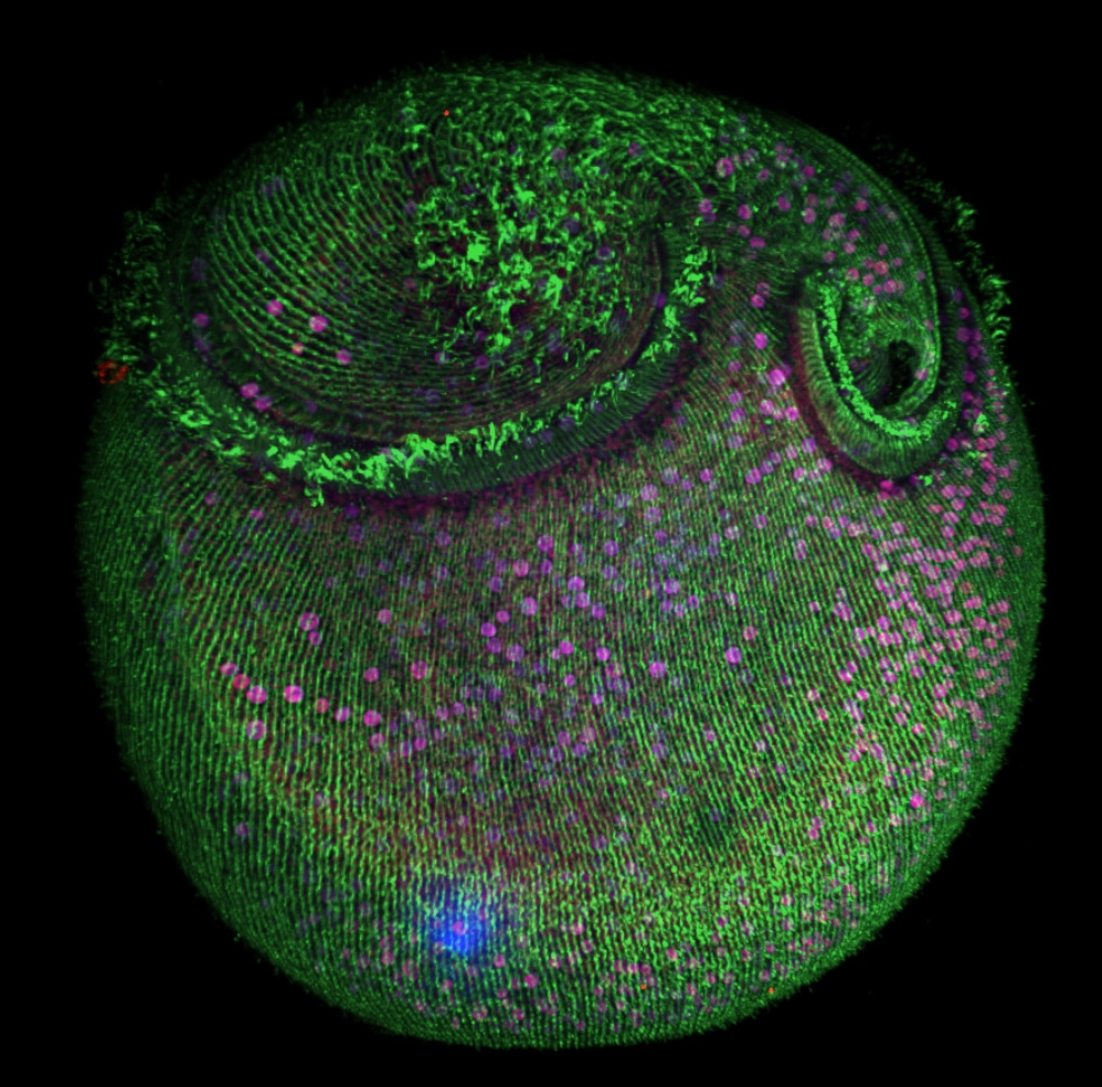 Stentor captured on an Andor Dragonfly confocal microscope. The green is the microtubule cytoskeleton, the blue is DAPI staining DNA and the magenta are the endosymbiotic algae. 