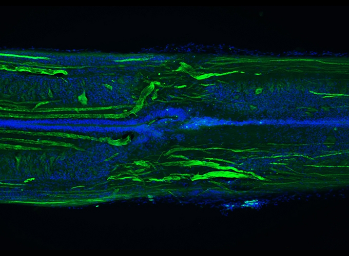 Image of a lamprey spinal cord showing many axons (green) regenerating across the injury site (center).