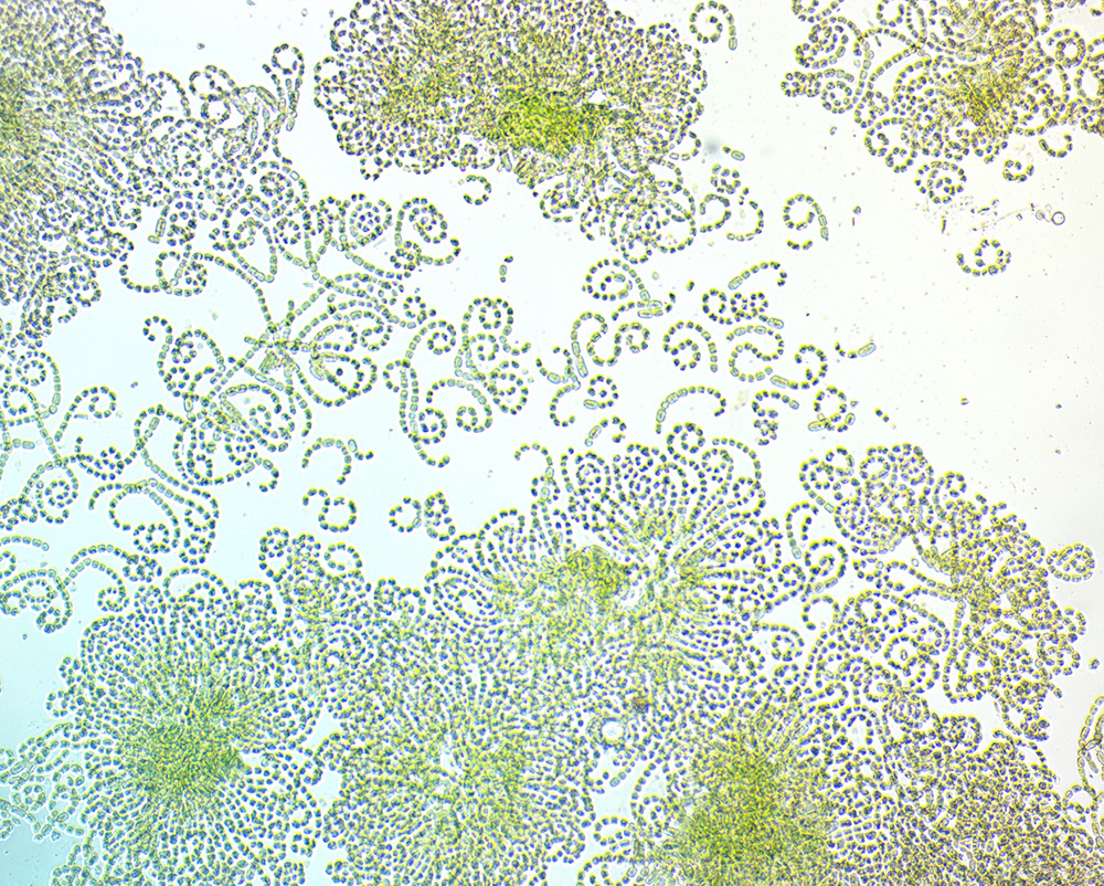 filamentous cyanobacteria