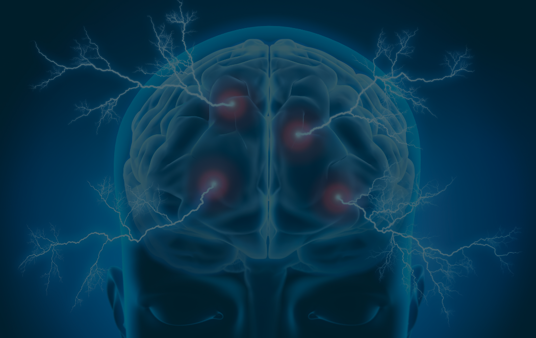 Graphic of a brain depicting activity.