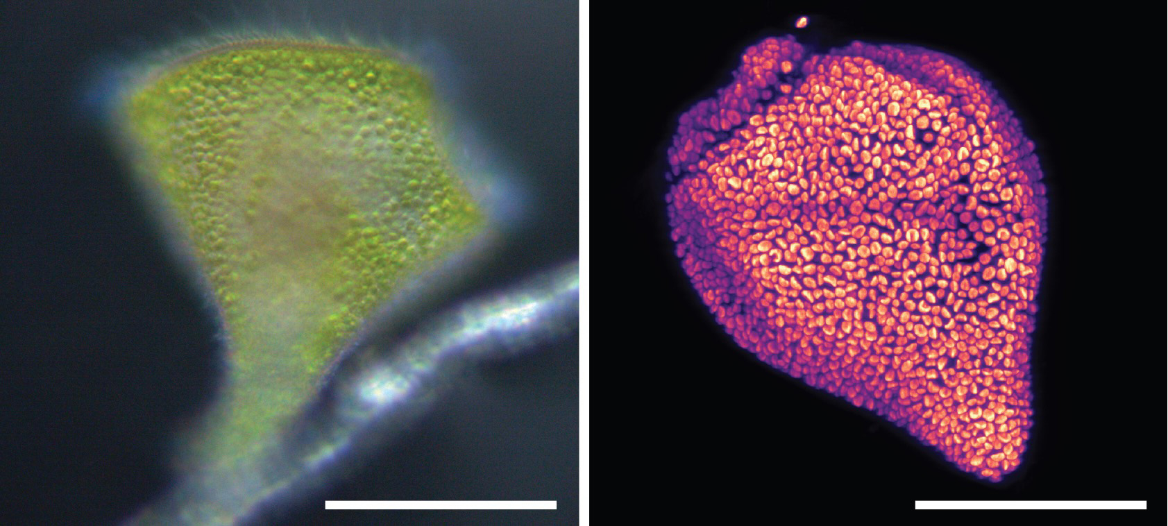 Stentor stipatus contains endosymbiotic algae, the green of which mixes with a dark pigment to give the species a reddish-brown color. Left: Dense cortical packing of algal cells in the S. stipatus cell. Right: Autofluorescence of the algae. Scale bar approx. 100 microns. 