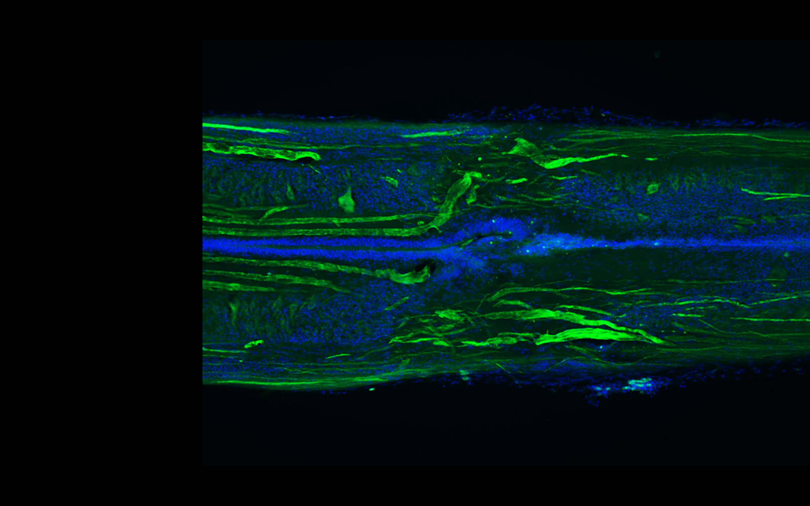 Microscopy image of regenerating lamprey spinal cord.