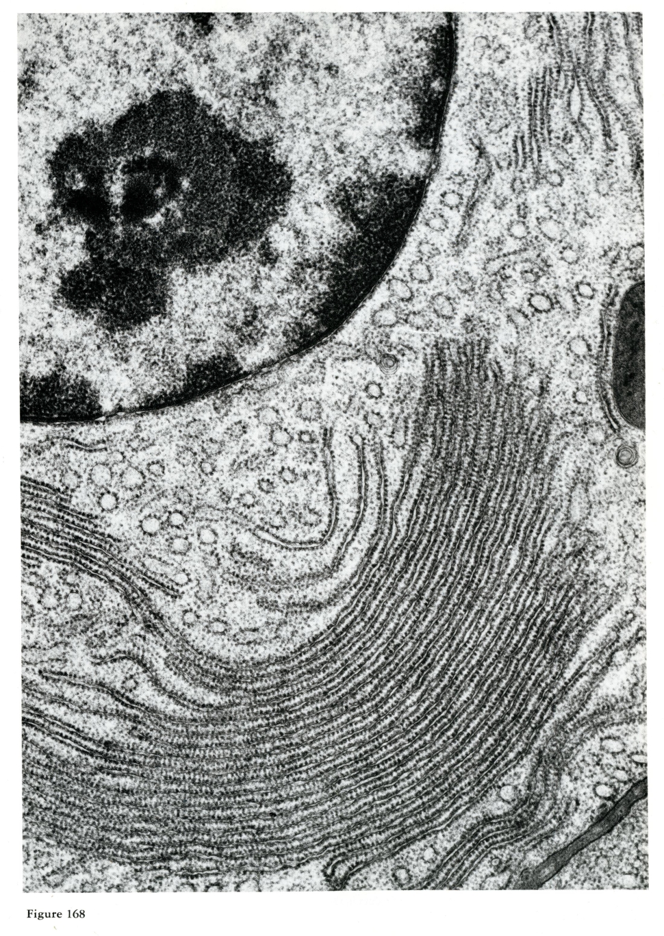 A highly magnified view of the endoplasmic reticulum via EM