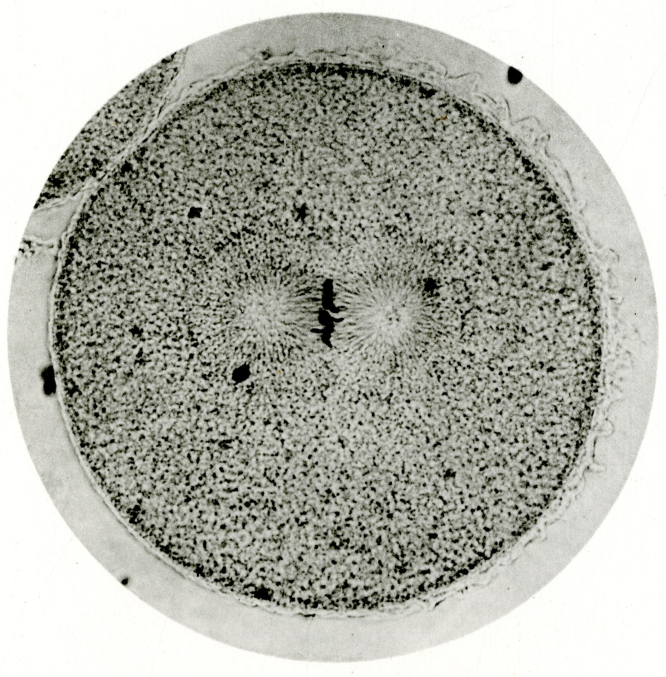 Image of chromosomes, spindle and asters in an egg division