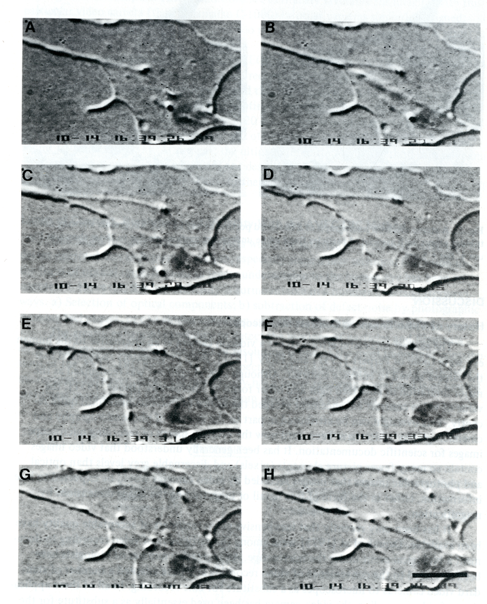 Microtubules and vesicles in the axon in 1981