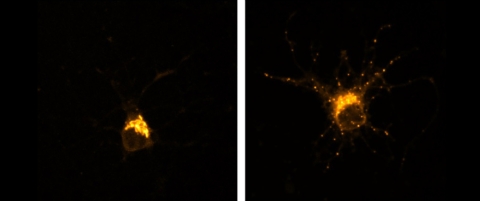 neurons treated with nicotine