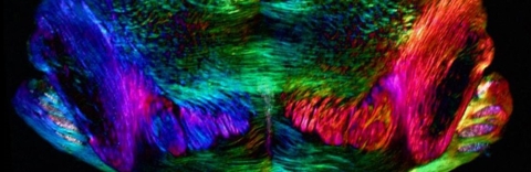 Mouse coronal brainstem, birefringence image. Credit: Michael Shribak and Timothy Balmer
