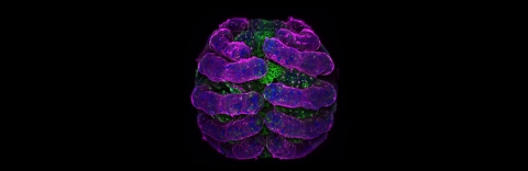 Parasteatoda tepidariorum (spider embryo) stained for embryo surface (pink), nuclei (blue) and microtubules (green). Credit: Tessa Montague