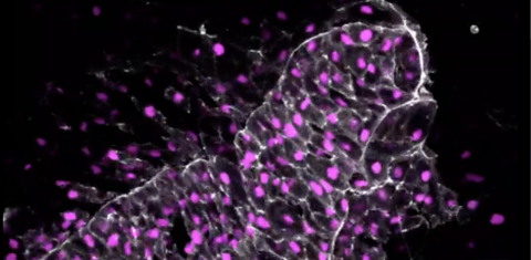 The cellular skeletal protein actin (grey) marks the cell edges and the nucleus is is in magenta.