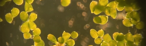 Stentor pyriformis with photosynthetic algae