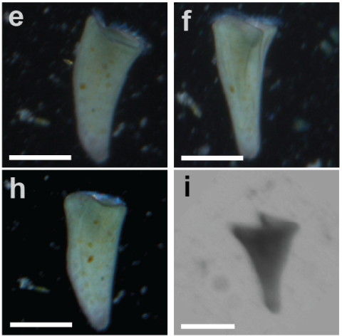Microscopy images of a stentor