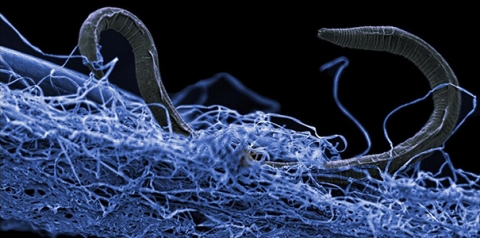 A nematode (eukaryote) in a biofilm of microorganisms. 