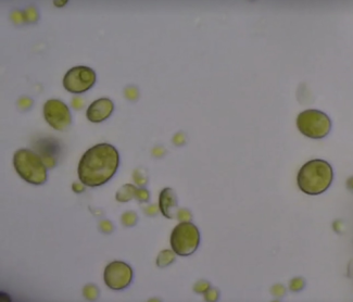 algal cells under microscope